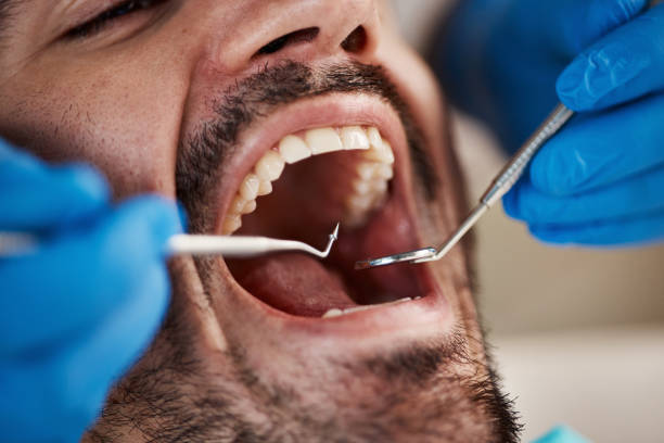 Best Emergency Treatment for Dental Infections or Abscesses in Conrad, MT