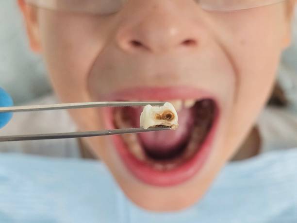 Best Emergency Denture Repair in Conrad, MT