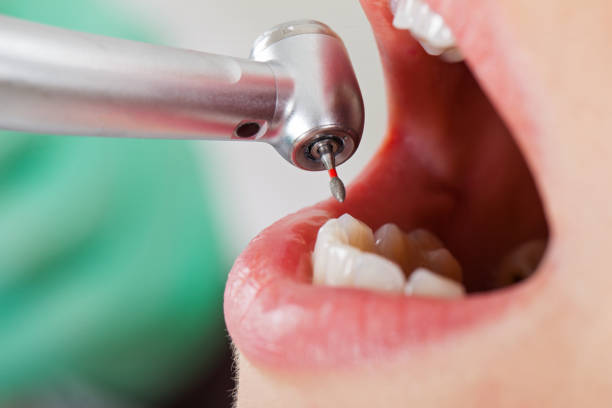 Best Emergency Dental Care for Broken or Chipped Teeth in Conrad, MT